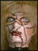 [Suture]